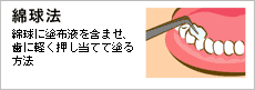 綿球法