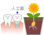 人工歯