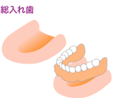 総入れ歯