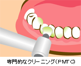 プロフェッショナルケア
